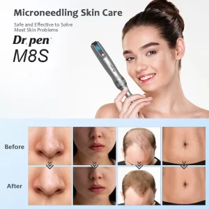 Dr. Pen M8S マイクロニードル美容機器 使用前と使用後の効果の比較