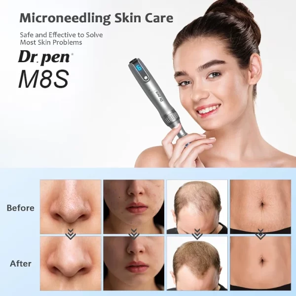 Dr. Pen M8S マイクロニードル美容機器 使用前と使用後の効果の比較