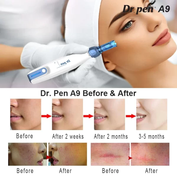 Dr.penA9マイクロニードル美容機器 使用効果ショー、比較前後の異なるサイクルの皮膚