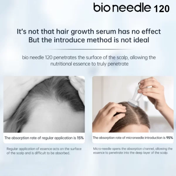 bio needle 120 ダーマ・ステムペ発毛効果