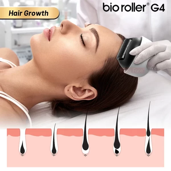 Bio Roller G4 1200針 ダーマローラー 脱毛防止