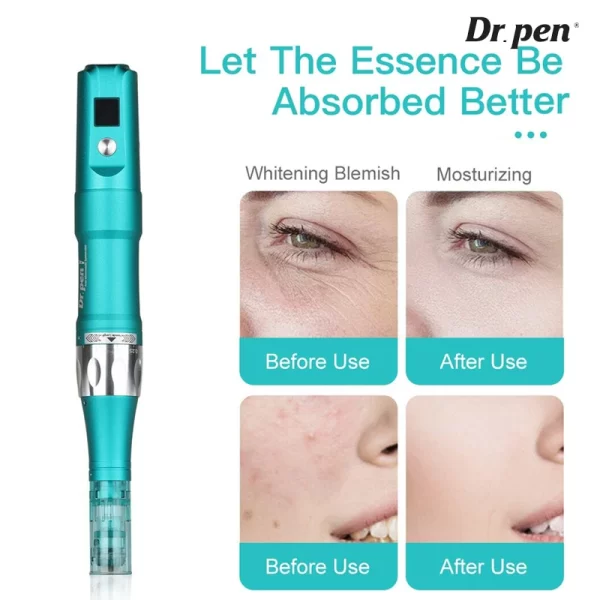 Dr. Pen A6S Ultima マイクロニードル美容機器 使用前後の効果比較