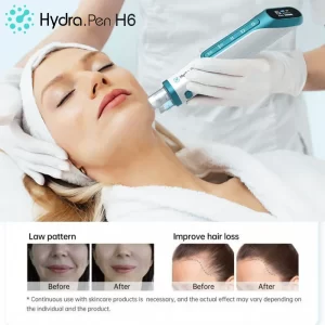 Hydra Pen H6を肌と頭皮に使用したビフォーアフター