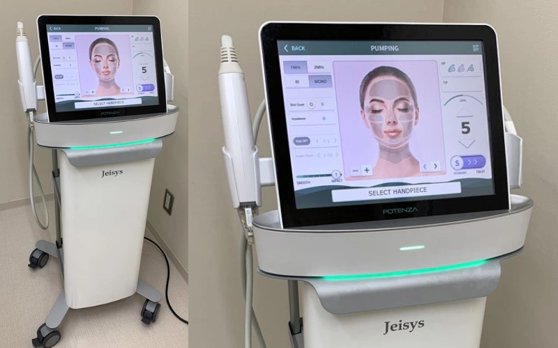 potenza rf microneedling