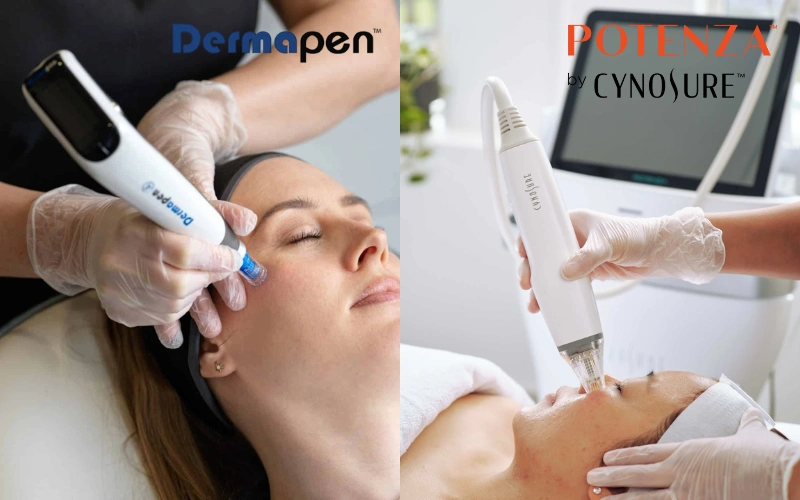 potenza vs dermapen