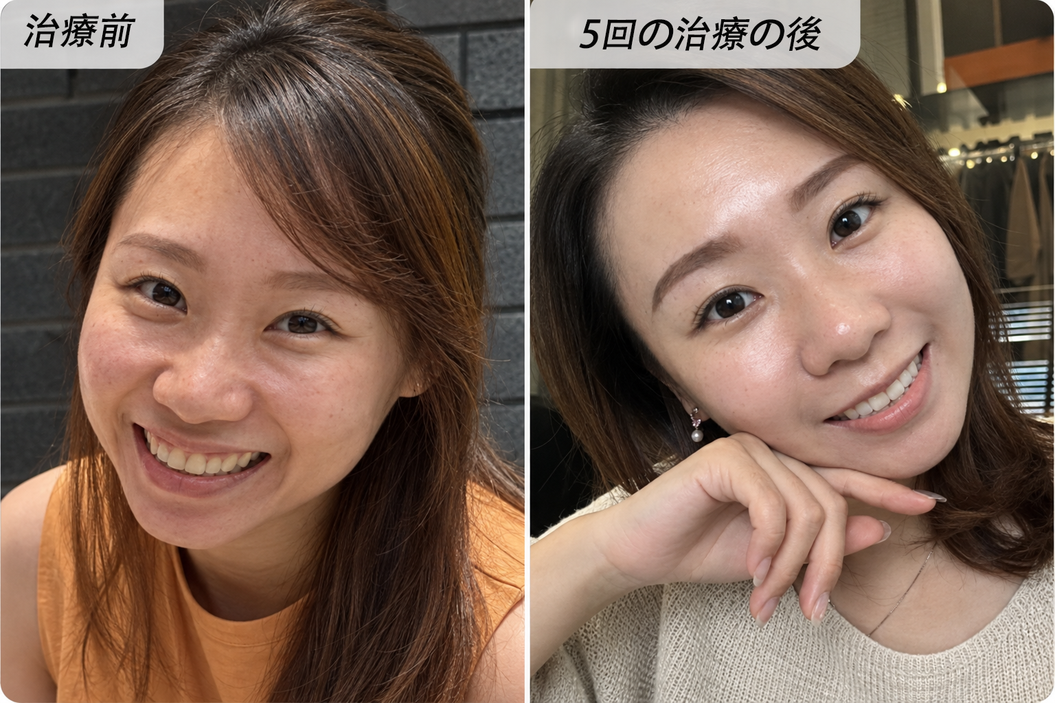出典に掲載された比較画像（効果・購入事実は未検証）
