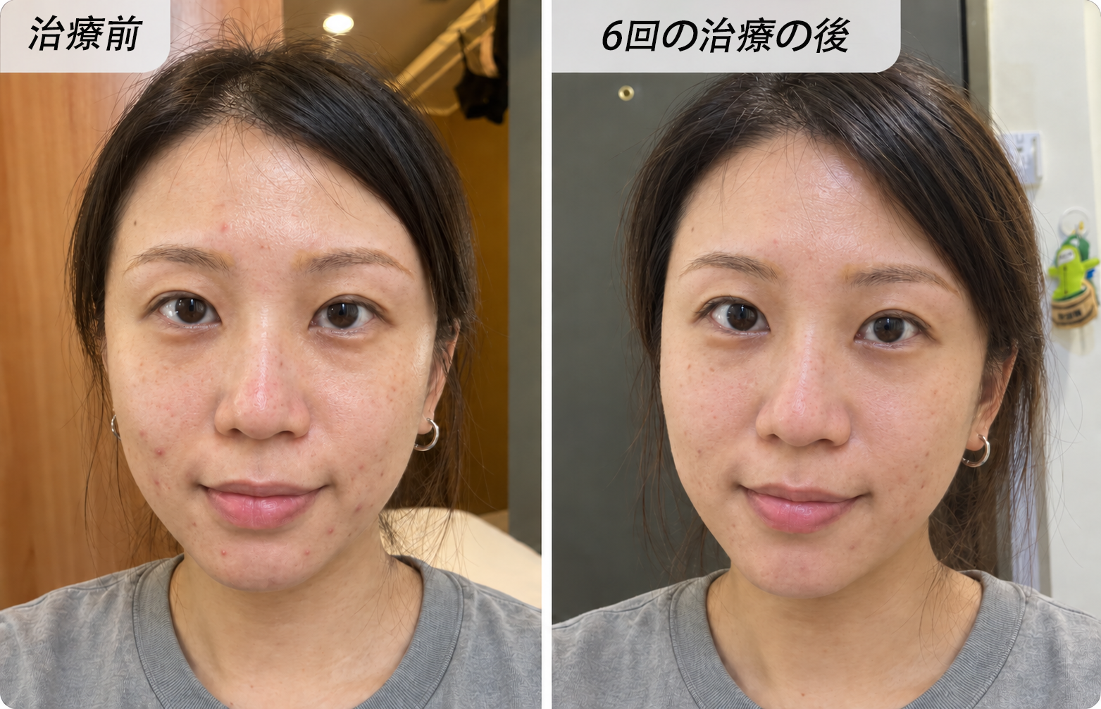 出典に掲載された比較画像（効果・購入事実は未検証）